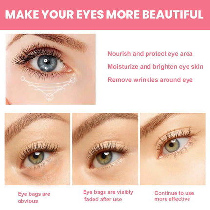 FFOrder Instant Facial Firming Eye Cream Stick Removes Dark Circles Around The Eyes, Reduces Fine Lines, Tightens And Lifts, And Moisturizes The Skin