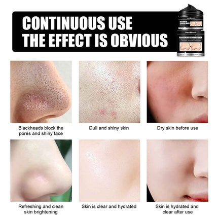 Bamboo Charcoal Pore Cleansing Peel-Off Mask for Blackhead Removal and Acne Treatment