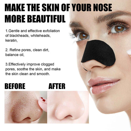Activated Charcoal Pore Cleansing Strip