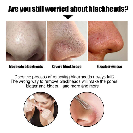 Activated Charcoal Pore Cleansing Strip