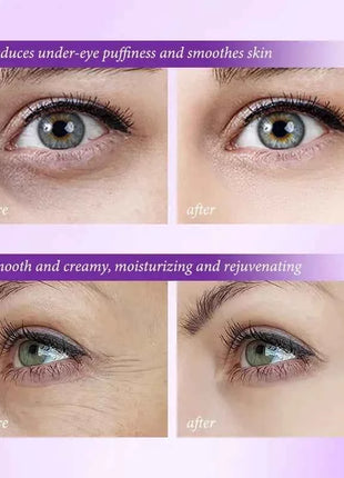 Instant Eye Bag Removal Cream Retinol Anti-Wrinkle Firming Skin Fade Fine Lines Anti Dark Circle Puffiness Brighten Eye skinCare