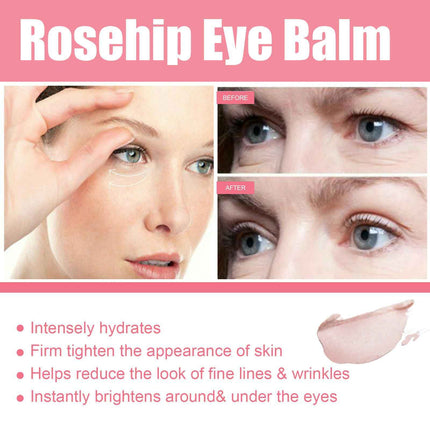 FFOrder Instant Facial Firming Eye Cream Stick Removes Dark Circles Around The Eyes, Reduces Fine Lines, Tightens And Lifts, And Moisturizes The Skin
